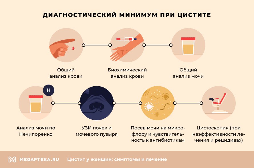 Диагностический минимум при цистите