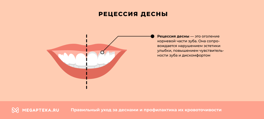 Кровь из десны и гемоглобин
