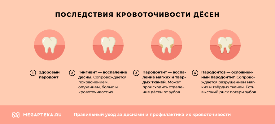 Железо во рту причины